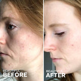 Refresh Papaya + Salicylic Acid Cleanser (100mL) and